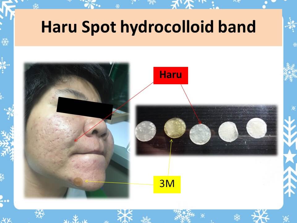 Haru,Spot Hydrocolloid Band,แผ่นซับสิว