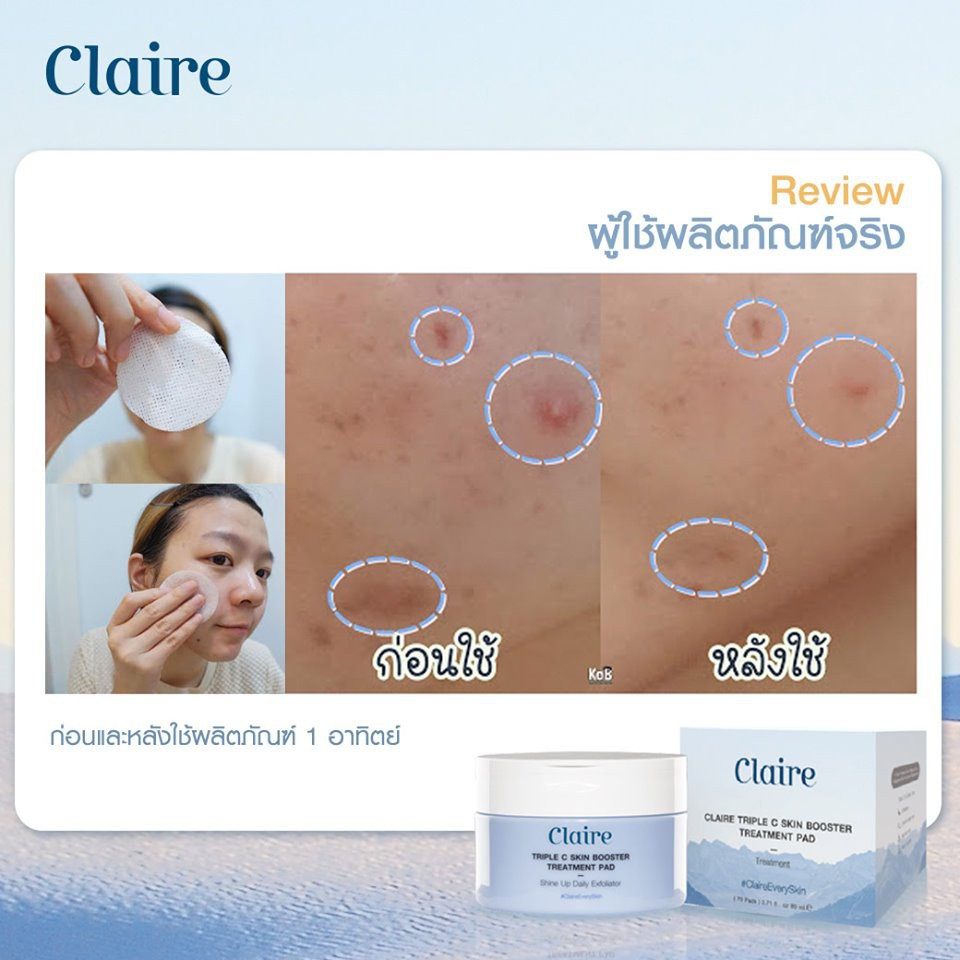 Claire Triple C Skin Booster Treatment Pad 7แผ่น/1ซอง สำลีแผ่นชุบสารบำรุงที่อุดมไปด้วยวิตามินซี 3 ช่วยบำรุงและผลัดเซลล์ผิว ทำให้ผิวเรียบเนียน นุ่ม ชุ่มชื่น