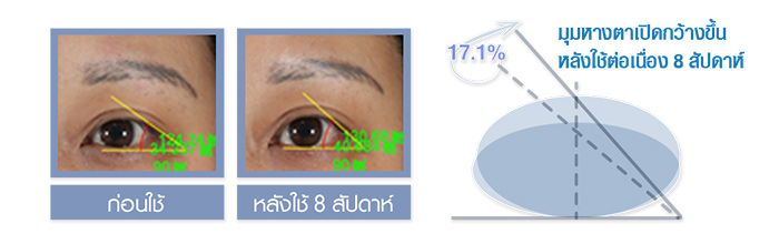 LaneigePerfect Renew Eye Serum EX 14 ml  หางตายกขึ้นอย่างเห็นได้ชัด ให้ผิวรอบดวงตากระจ่างใส ชุ่มชื้นขั้นสุด