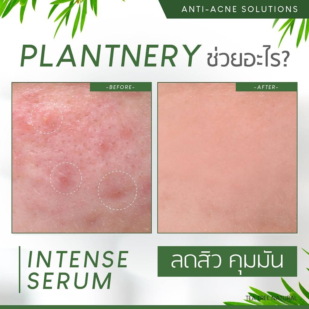 Plantnery Tea Tree Intense Serum