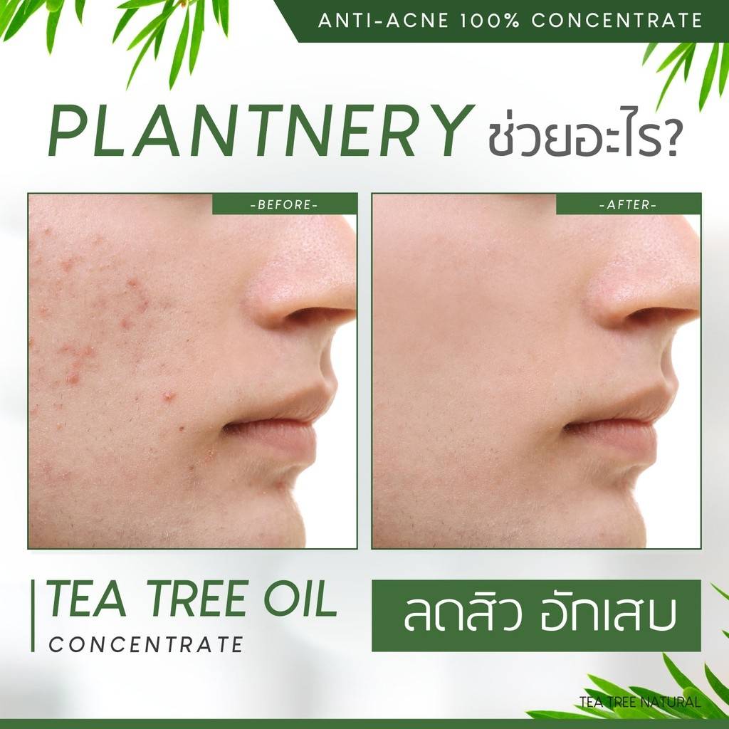 Plantnery Tea Tree Oil Concentrate