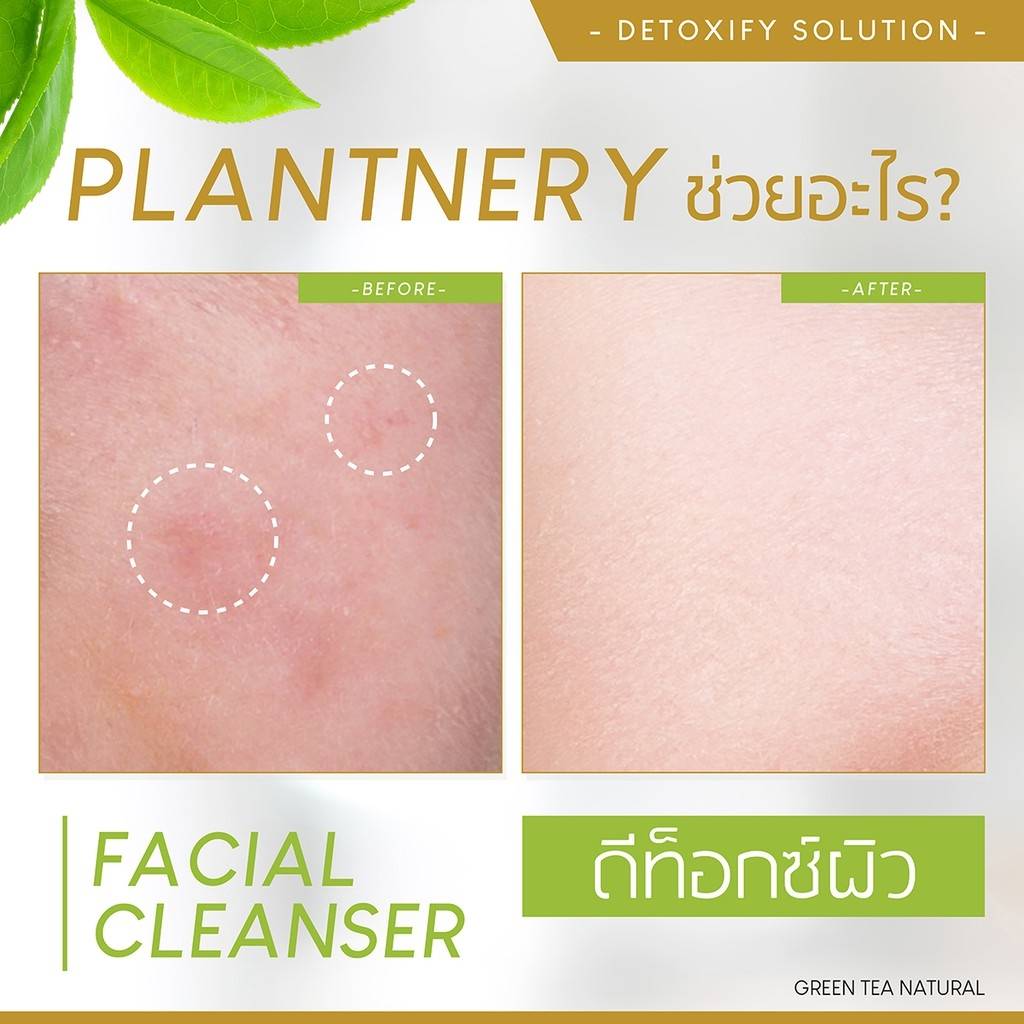 Plantnery Green Tree Facial Cleanser 