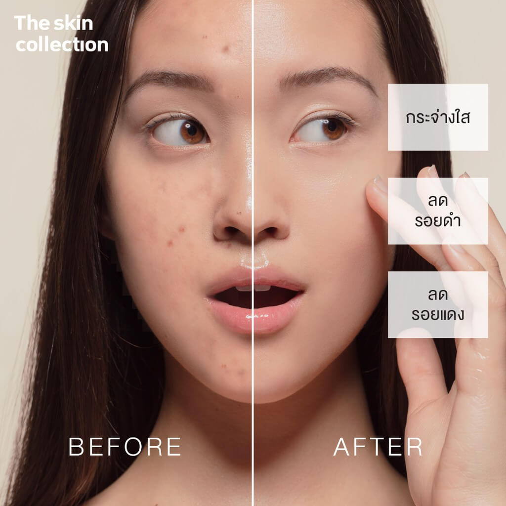 The Skin Collection,The Skin Collection Serum,Niacinamide,เซรั่ม,ซีรั่ม,