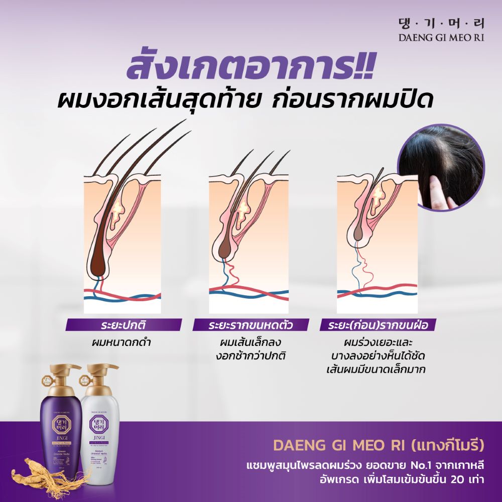 DAENG-GI-MEO-RI Shampoo 500 ml (Jingi Anti-Hair Loss) 500ml,DAENG-GI-MEO-RI, DAENG-GI-MEO-RI แชมพู , DAENG-GI-MEO-RI ลดผมร่วง , DAENG-GI-MEO-RI รีวิว , แชมพูลดผมร่วง  