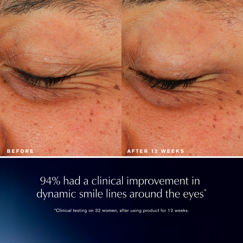 ESTEE LAUDER ANR Eye Lift & Sculpt